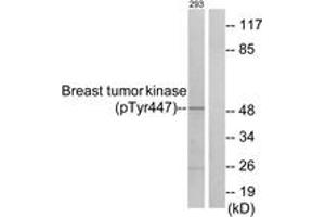 Western blot analysis of extracts from 293 cells treated with EGF 200ng/ml 30', using Breast Tumor Kinase (Phospho-Tyr447) Antibody. (PTK6 antibody  (pTyr447))