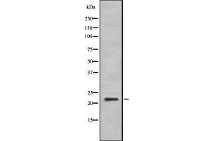 Western blot analysis IFNA6 using HeLa whole cell lysates (IFNA6 antibody  (C-Term))