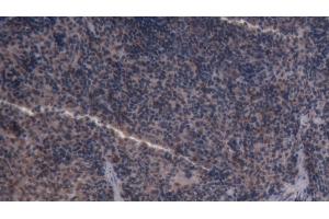 Detection of CASP3 in Rat Spleen Tissue using Polyclonal Antibody to Caspase 3 (CASP3) (Caspase 3 antibody  (AA 29-175))