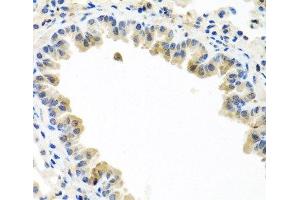 Immunohistochemistry of paraffin-embedded Mouse lung using BMP5 Polyclonal Antibody at dilution of 1:100 (40x lens). (BMP5 antibody)
