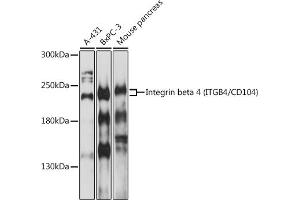 Western blot analysis of extracts of various cells, using Integrin beta 4 (ITGB4/CD104) antibody (ABIN1680489, ABIN3015361, ABIN3015362 and ABIN6214007) at 1:1000 dilution. (Integrin beta 4 antibody  (AA 28-310))