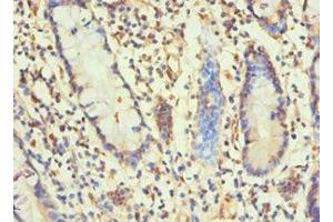 Immunohistochemistry of paraffin-embedded human small intestine tissue using ABIN7155347 at dilution of 1:100 (Histone H1-Like (LOC107807853) (AA 1-194) antibody)