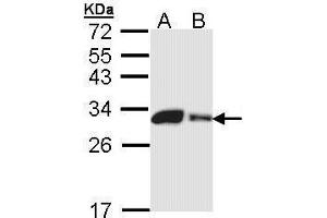 WB Image Sample (30 ug of whole cell lysate) A: 293T B: A431 , 12% SDS PAGE antibody diluted at 1:1000 (CA2 antibody)