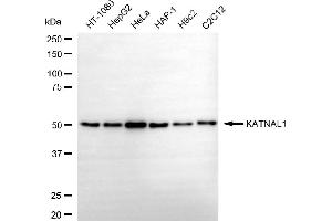 anti-Katanin P60 Subunit A-Like 1 (KATNAL1) antibody