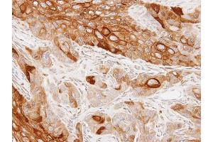 IHC-P Image Immunohistochemical analysis of paraffin-embedded SCC4 xenograft, using GAS2L1, antibody at 1:100 dilution. (GAS2L1 antibody)