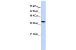 Image no. 1 for anti-ATPase, H+/K+ Exchanging, beta Polypeptide (ATP4b) (AA 215-264) antibody (ABIN6740866) (ATP4b antibody  (AA 215-264))