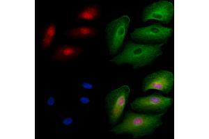 ABIN6257569 and ABIN6275749 staining  cells by IF/ICC.