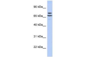 WB Suggested Anti-C3orf39 Antibody Titration:  0.