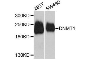 Western blot analysis of extracts of various cell lines, using DNMT1 antibody. (DNMT1 antibody  (AA 1-270))