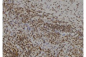 ABIN6278680 at 1/100 staining Human spleen tissue by IHC-P. (FSBP antibody  (Internal Region))