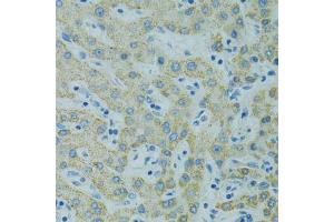 Immunohistochemistry of paraffin-embedded human liver using STX1A antibody (ABIN1876774) at dilution of 1:100 (40x lens).