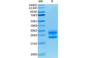 Mouse IL-17A on Tris-Bis PAGE under reduced condition. (Interleukin 17a Protein (AA 26-158) (His-Avi Tag))