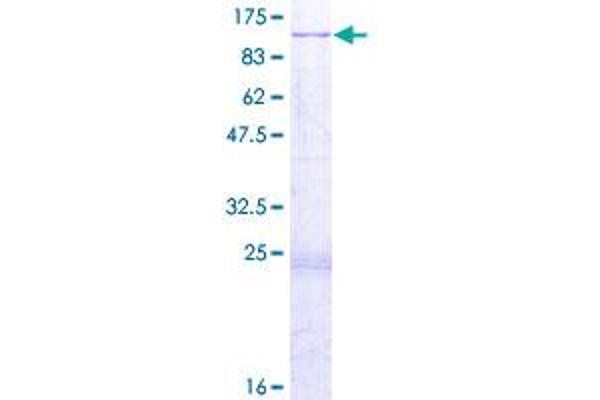 IFT81 Protein (AA 1-676) (GST tag)