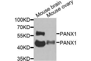 Western blot analysis of extracts of mouse brain and mouse ovary cells, using PANX1 antibody.