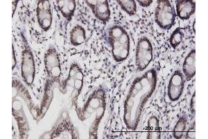 Immunoperoxidase of purified MaxPab antibody to ILF3 on formalin-fixed paraffin-embedded human small Intestine. (Interleukin enhancer-binding factor 3 (ILF3) (AA 1-702) antibody)