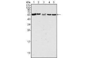 Western Blot showing PAK2 antibody used against Hela (1), Jurkat (2), A549 (3), HEK293 (4) and K562 (5) cell lysate. (PAK2 antibody)