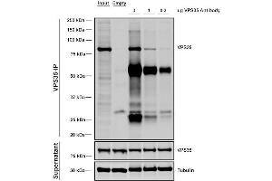 Immunoprecipitation analysis using Mouse Anti-VPS35 Monoclonal Antibody, Clone 11H10 (ABIN6933004).