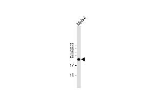 All lanes : Anti-ORMDL3 Antibody (Center) at 1:1000 dilution Lane 1: Molt-4 whole cell lysate Lysates/proteins at 20 μg per lane. (ORMDL3 antibody  (AA 53-81))