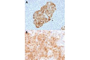 Immunohistochemical staining (Formalin-fixed paraffin-embedded sections) of human pancreas (A) and human parathyroid (B) with CHGA recombinant monoclonal antibody, clone CHGA/1731R . (Recombinant Chromogranin A antibody)