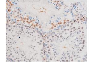 Immunohistochemistry (IHC) image for anti-GATA Binding Protein 4 (GATA4) (pSer105) antibody (ABIN6256094)