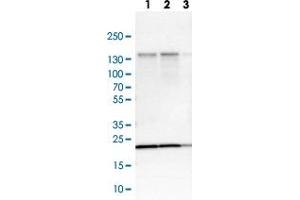 Western blot analysis of Lane 1: NIH-3T3 cell lysate (Mouse embryonic fibroblast cells) Lane 2: NBT-II cell lysate (Rat Wistar bladder tumour cells) Lane 3: PC12 cell lysate (Pheochromocytoma of rat adrenal medulla) with EIF4ENIF1 polyclonal antibody  at 1:250-1:500 dilution. (EIF4ENIF1 antibody)