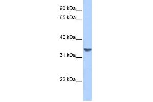 WB Suggested Anti-RAB40A Antibody Titration: 0. (RAB40A antibody  (Middle Region))