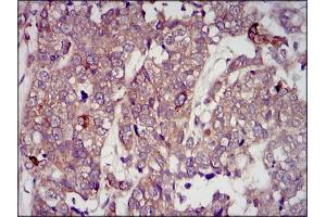 Immunohistochemistry (IHC) image for anti-Insulin-Like Growth Factor 2 (IGF2) (AA 25-180) antibody (ABIN1098108)
