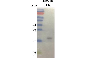 Western Blot Confirmation of HPV16 E6 proteins (Human Papilloma Virus 16 E6 (HPV-16 E6) (AA 1-158) antibody)