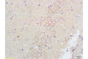 Formalin-fixed and paraffin embedded rat brain tissue labeled with Anti-GABRA1 Polyclonal Antibody, Unconjugated at 1:200 followed by conjugation to the secondary antibody and DAB staining (GABRA1 antibody  (AA 301-450))