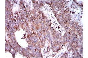 Immunohistochemistry (IHC) image for anti-Signal Transducer and Activator of Transcription 5A (STAT5A) (AA 583-794) antibody (ABIN1845625) (STAT5A antibody  (AA 583-794))