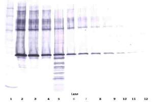 Western Blotting (WB) image for anti-serpin Peptidase Inhibitor, Clade B (Ovalbumin), Member 5 (SERPINB5) antibody (ABIN487960)