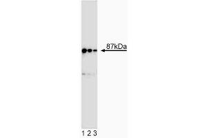 Western blot analysis of Ikkbeta. (IKBKB antibody  (AA 1-666))