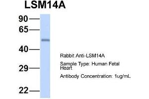 Host: Rabbit  Target Name: LSM14A  Sample Tissue: Human Fetal Heart  Antibody Dilution: 1. (LSM14A antibody  (C-Term))