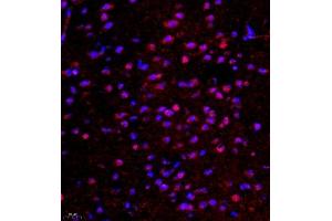 Immunofluorescence of paraffin embedded mouse brain using ghrelin (ABIN7074040) at dilution of 1:500 (400x lens) (Ghrelin antibody)