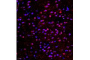 Immunofluorescence of paraffin embedded mouse brain using ghrelin (ABIN7074040) at dilution of 1:500 (400x lens)