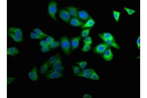 Immunofluorescence staining of HepG2 cells with ABIN7169172 at 1:100, counter-stained with DAPI. (Sbk2 antibody  (AA 62-330))