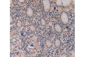 Used in DAB staining on fromalin fixed paraffin- embedded stomach tissue (VPREB1 antibody  (AA 33-135))