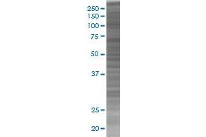 RASA1 transfected lysate. (RASA1 293T Cell Transient Overexpression Lysate(Denatured))