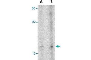 Western blot analysis of NRN1 in Daudi cell lysate with NRN1 polyclonal antibody  at (A) 5 and (B) 10 ug/mL . (NRN1 antibody  (Internal Region))