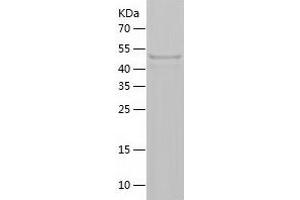 Western Blotting (WB) image for Ankyrin Repeat Domain 13A (ANKRD13A) (AA 428-590) protein (His-IF2DI Tag) (ABIN7284068) (ANKRD13A Protein (AA 428-590) (His-IF2DI Tag))