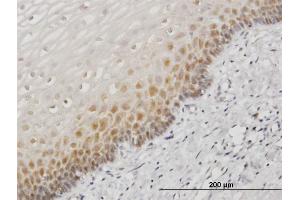 Immunoperoxidase of monoclonal antibody to HSPA1B on formalin-fixed paraffin-embedded human esophagus. (HSPA1B antibody  (AA 531-611))