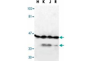 Western blot analysis of DFFA in HeLa, (H), K-562 (K), Jurkat (J), and Raji (R) whole cell lysate with DFFA polyclonal antibody  at 1 : 1000 dilution. (DFFA antibody  (AA 2-21))