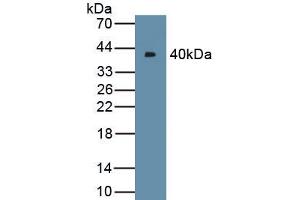 Detection of Recombinant NODAL, Human using Polyclonal Antibody to Nodal Homolog (NODAL) (Nodal antibody  (AA 27-347))