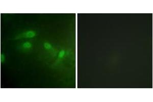 Immunofluorescence analysis of HeLa cells, using MDM2 (Phospho-Ser186+Ser188) Antibody. (MDM2 antibody  (pSer186))