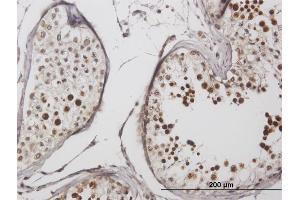 Immunoperoxidase of purified MaxPab antibody to LYAR on formalin-fixed paraffin-embedded human testis. (LYAR antibody  (AA 1-379))