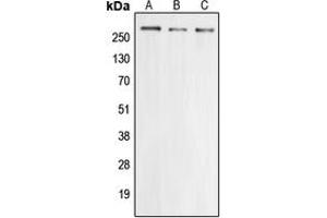 Western blot analysis of Cav2. (CACNA1E antibody  (Center))