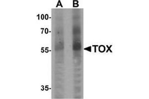 Western blot analysis of TOX in human colon tissue lysate with TOX Antibody  at (A) 1 and (B) 2 μg/ml. (TOX antibody  (N-Term))