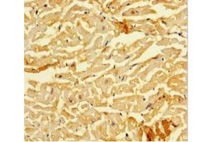 Immunohistochemistry of paraffin-embedded human heart tissue using ABIN7160220 at dilution of 1:100 (SMAD1 antibody  (AA 150-250))