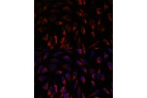 Immunofluorescence analysis of L929 cells using CHP1 antibody (ABIN7266008) at dilution of 1:100. (CHP antibody  (AA 1-195))