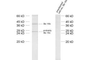 dilution: 1 : 1000, sample: crude synaptosomal fraction of rat brain (P2) (Syntaxin 16 antibody  (AA 1-302))